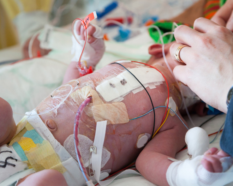 Pediatric Cardiac Surgery image