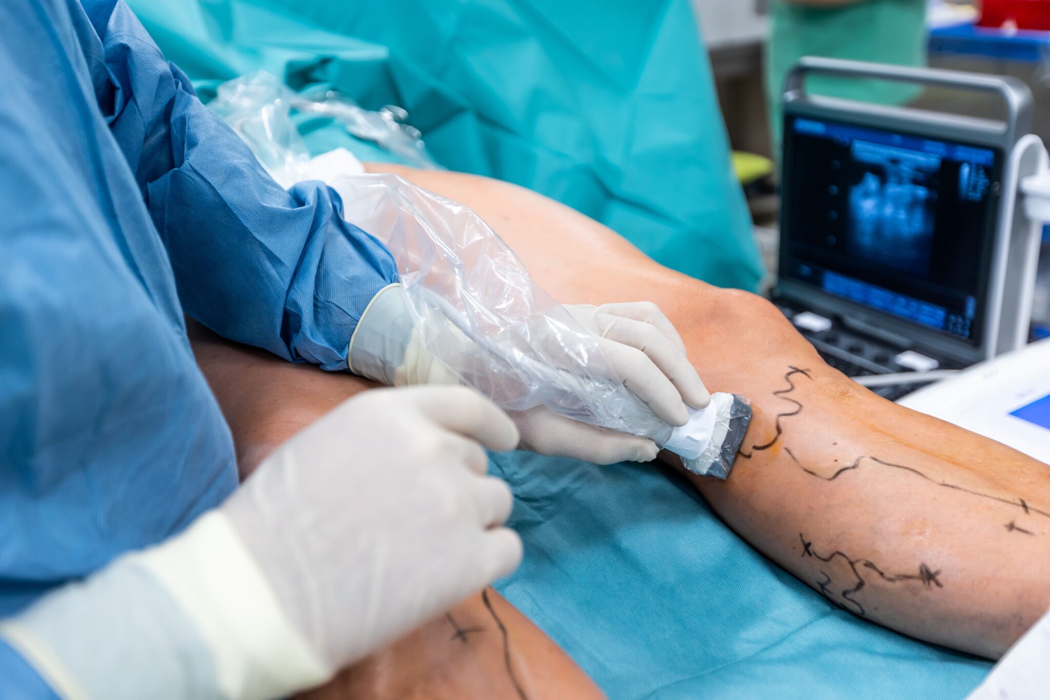 Vascular Surgery image